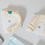 Waarom een orthodontie verzekering kiezen boven eigen kosten betalen?